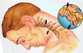 Departamentul Cervical