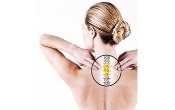 osteocondroza cervicală la o femeie